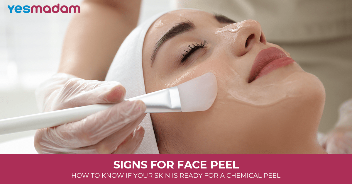 Signs for Face Peel: How to Know If Your Skin Is Ready for a Chemical Peel