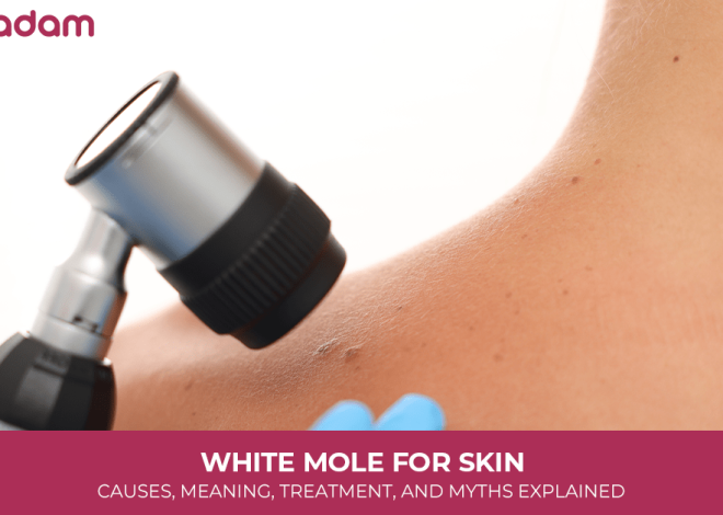 White Mole for Skin: Causes, Meaning, Treatment, and Myths Explained