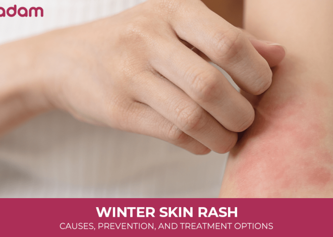 Winter Skin Rash: Causes, Prevention, and Treatment Options
