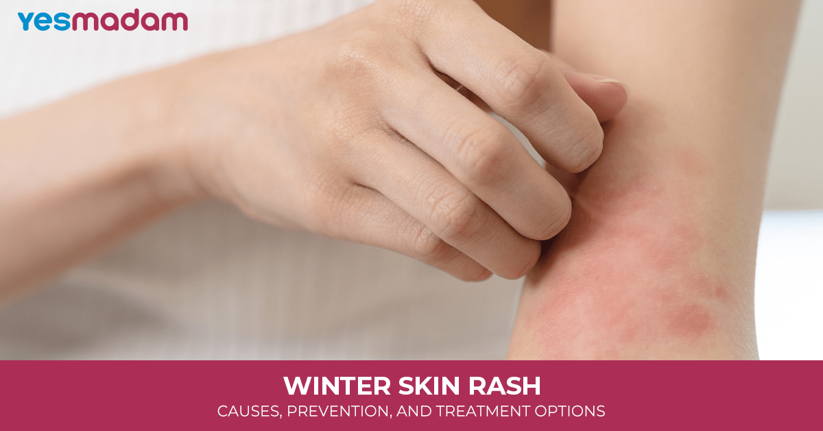 Winter Skin Rash: Causes, Prevention, and Treatment Options