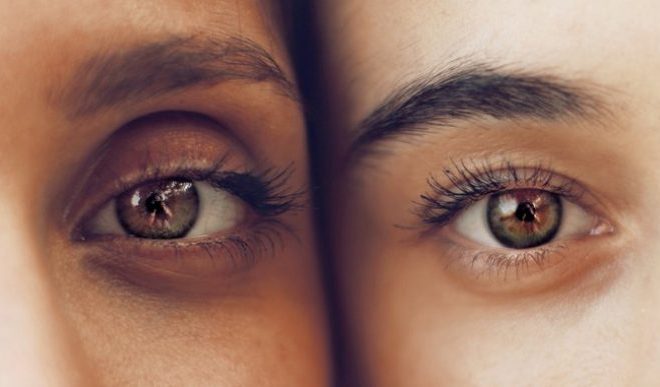 When Eyelid Surgery Is More Than A Matter Of Appearance