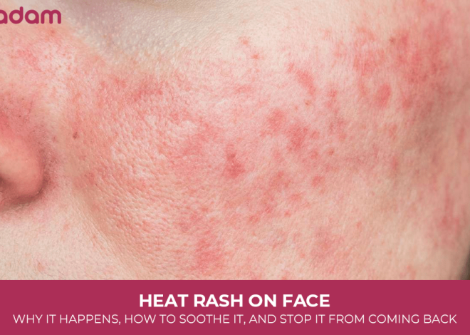 Heat Rash on Face: Why It Happens, How to Soothe It, and Stop It From Coming Back