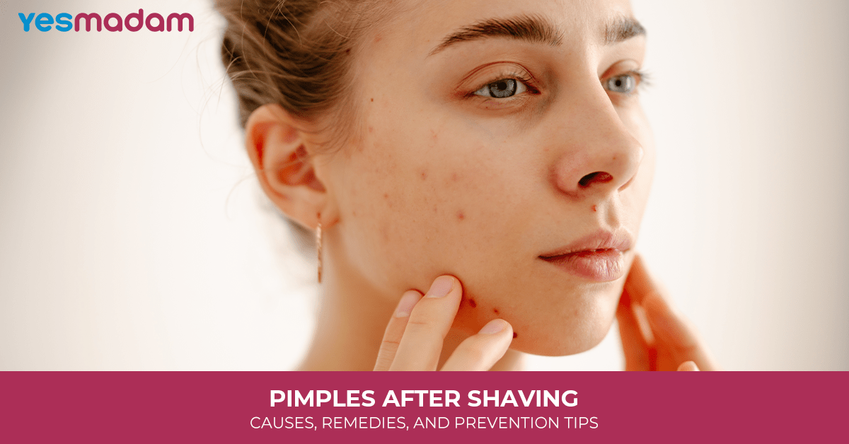 Pimples After Shaving: Causes, Remedies, and Prevention Tips