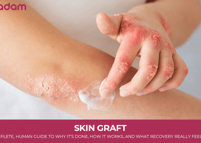 Skin Graft: A Complete, Human Guide to Why It’s Done, How It Works, and What Recovery Really Feels Like