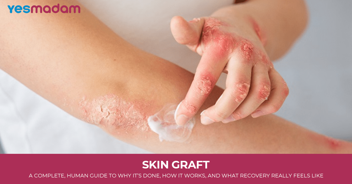 Skin Graft: A Complete, Human Guide to Why It’s Done, How It Works, and What Recovery Really Feels Like