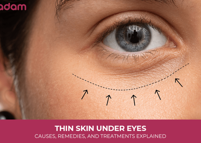Thin Skin Under Eyes: Causes, Remedies, and Treatments Explained