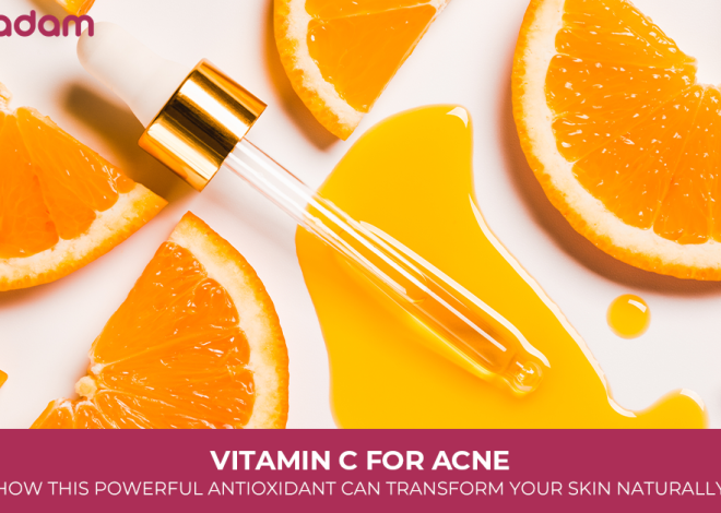 Vitamin C for Acne: How This Powerful Antioxidant Can Transform Your Skin Naturally